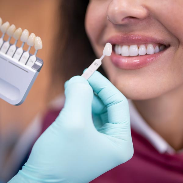 woman being matched for veneers